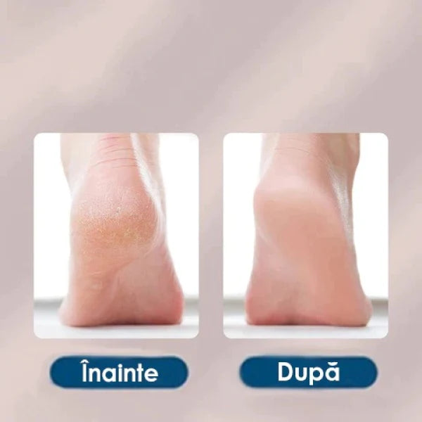 Cadita Pliabila Pentru Pedichiura, Foot Spa + Pila Electrica Pentru Calcaie, BeautyFeet